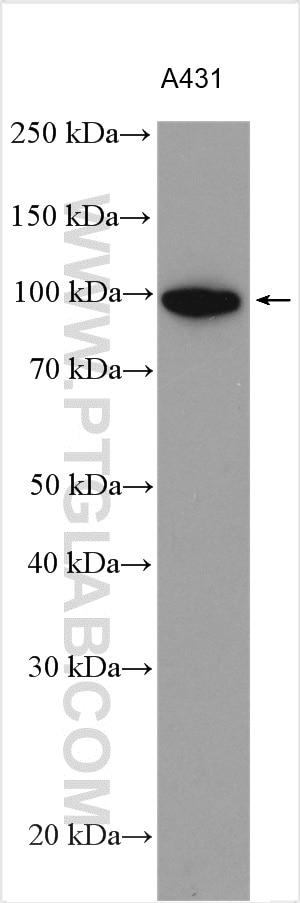 Western Blot (WB) analysis of various lysates using Integrin beta-6 Polyclonal antibody (28378-1-AP)