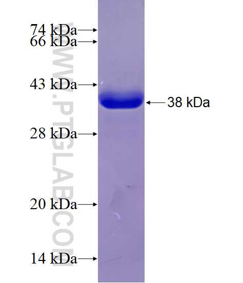 Integrin beta-6 fusion protein Ag29002 SDS-PAGE