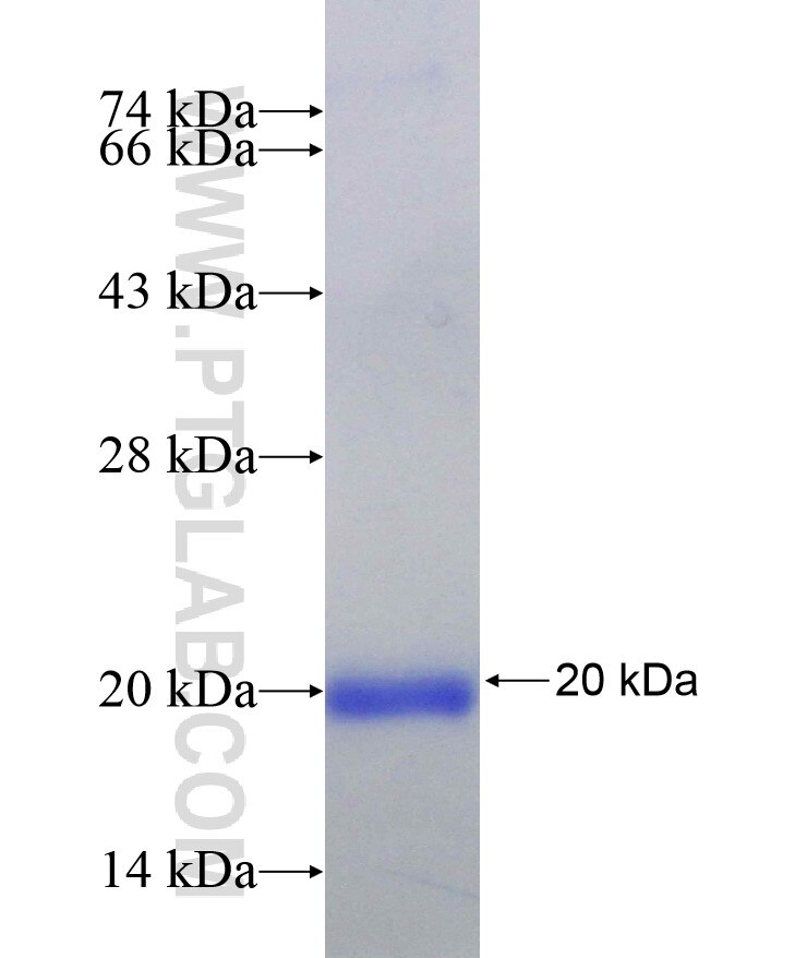 Integrin beta-6 fusion protein Ag29015 SDS-PAGE
