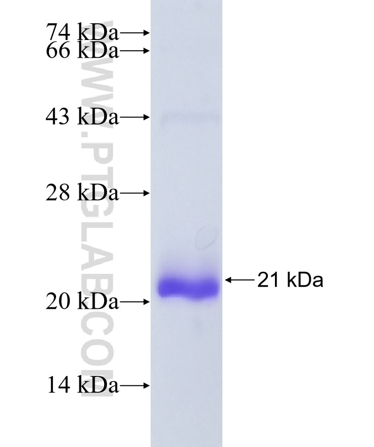 Integrin beta-6 fusion protein Ag29015 SDS-PAGE