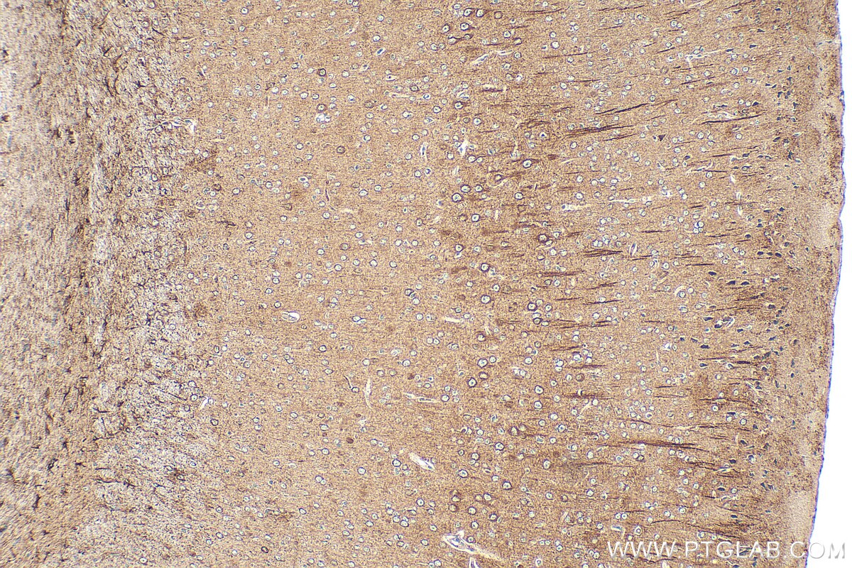 Immunohistochemical analysis of paraffin-embedded mouse brain tissue slide using 29775-1-AP (Integrin beta-8 antibody) at dilution of 1:200 (under 10x lens). Heat mediated antigen retrieval with Tris-EDTA buffer (pH 9.0). Immunohistochemistry (IHC) staining of mouse brain tissue using Integrin beta-8 Polyclonal antibody (29775-1-AP)