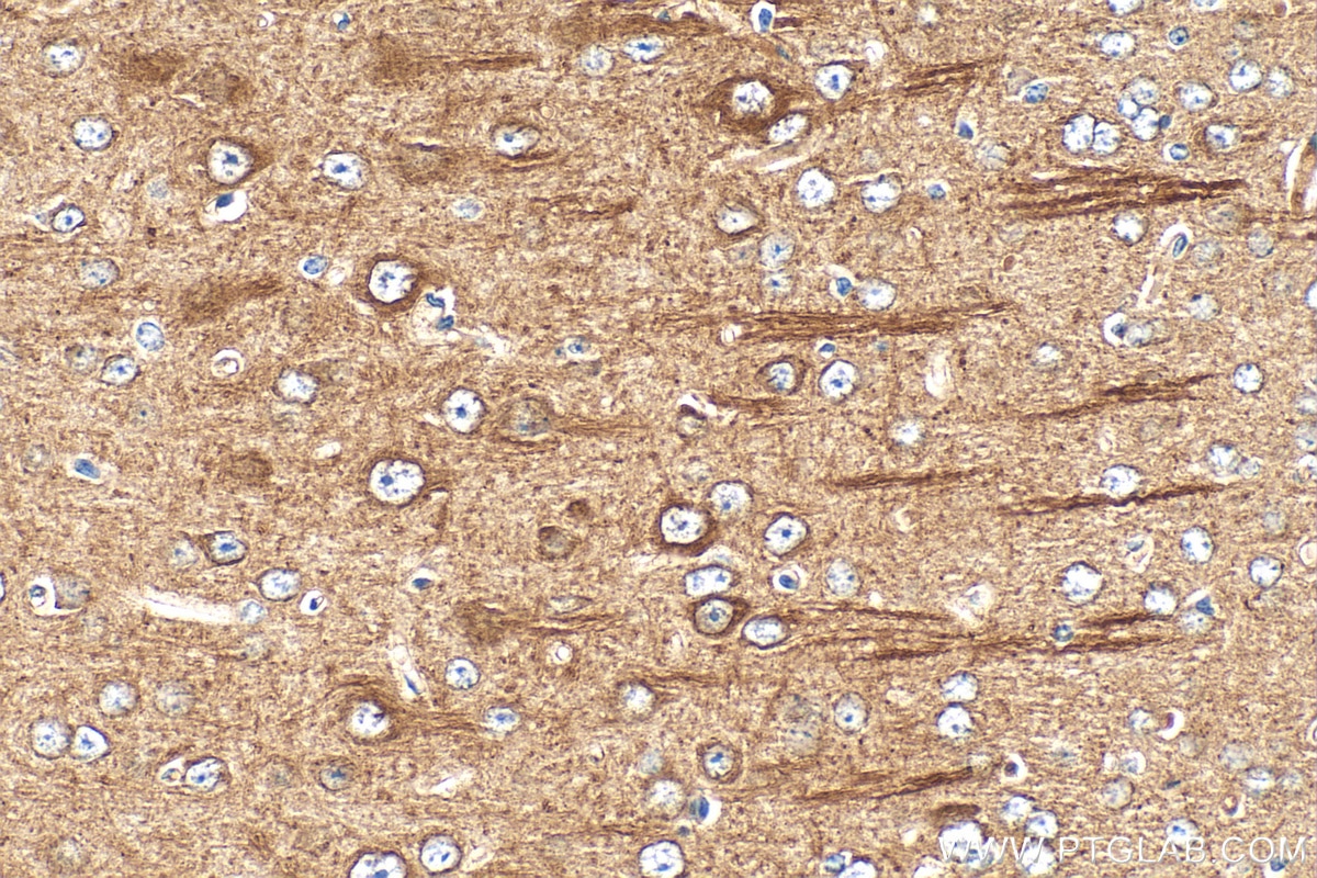 Immunohistochemical analysis of paraffin-embedded mouse brain tissue slide using 29775-1-AP (Integrin beta-8 antibody) at dilution of 1:200 (under 40x lens). Heat mediated antigen retrieval with Tris-EDTA buffer (pH 9.0). Immunohistochemistry (IHC) staining of mouse brain tissue using Integrin beta-8 Polyclonal antibody (29775-1-AP)