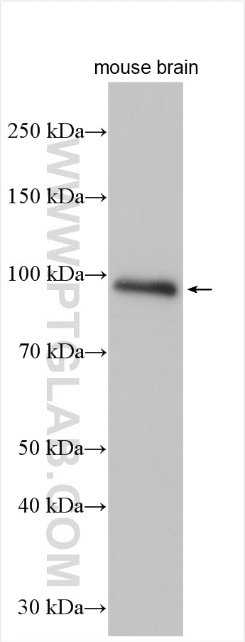 Western Blot (WB) analysis of mouse brain tissue using Integrin beta-8 Polyclonal antibody (29775-1-AP)