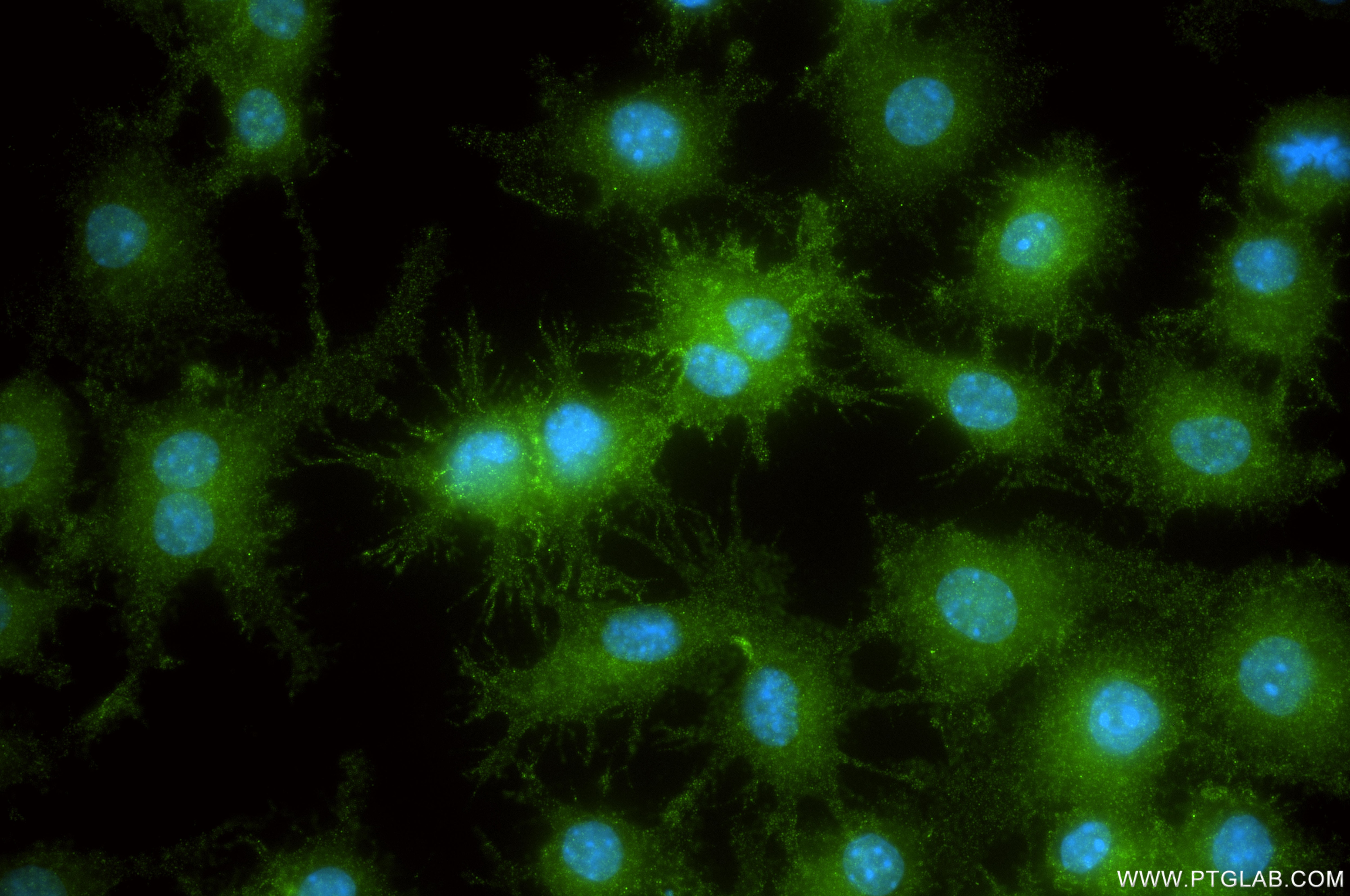 Immunofluorescence (IF) / fluorescent staining of RAW 264.7 cells using IFNAR2 Recombinant monoclonal antibody (87764-2-RR)