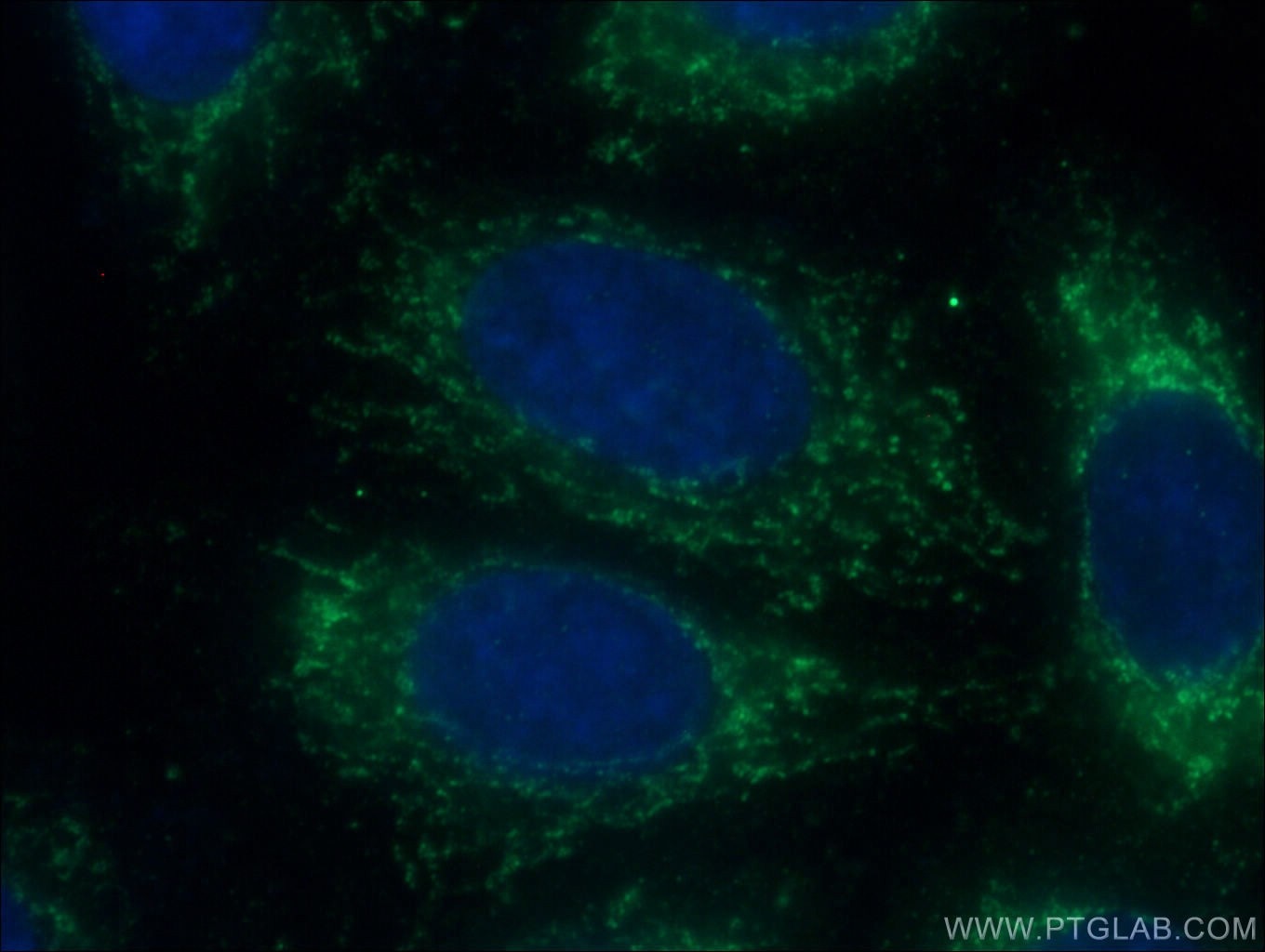 Immunofluorescence (IF) / fluorescent staining of HepG2 cells using IFN Beta Polyclonal antibody (27506-1-AP)