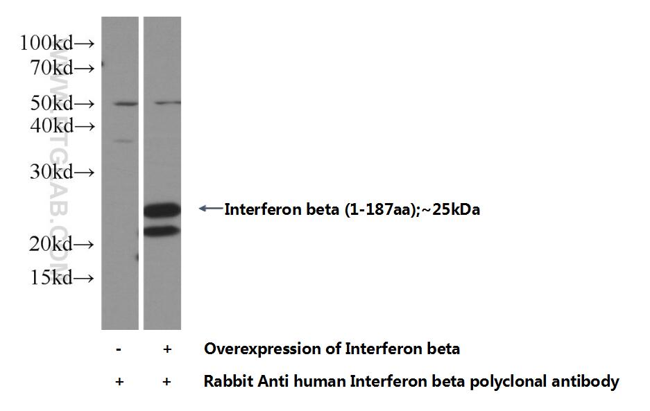 IFN Beta