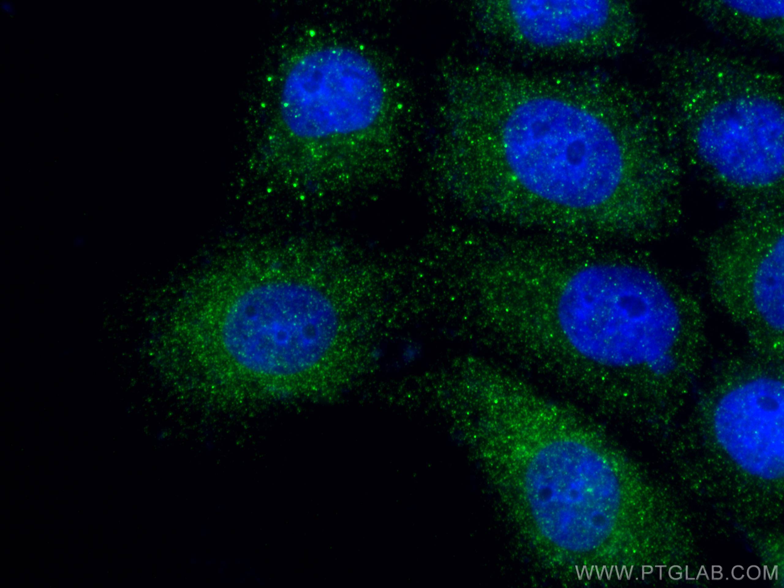 Immunofluorescence (IF) / fluorescent staining of A431 cells using Involucrin Polyclonal antibody (28462-1-AP)
