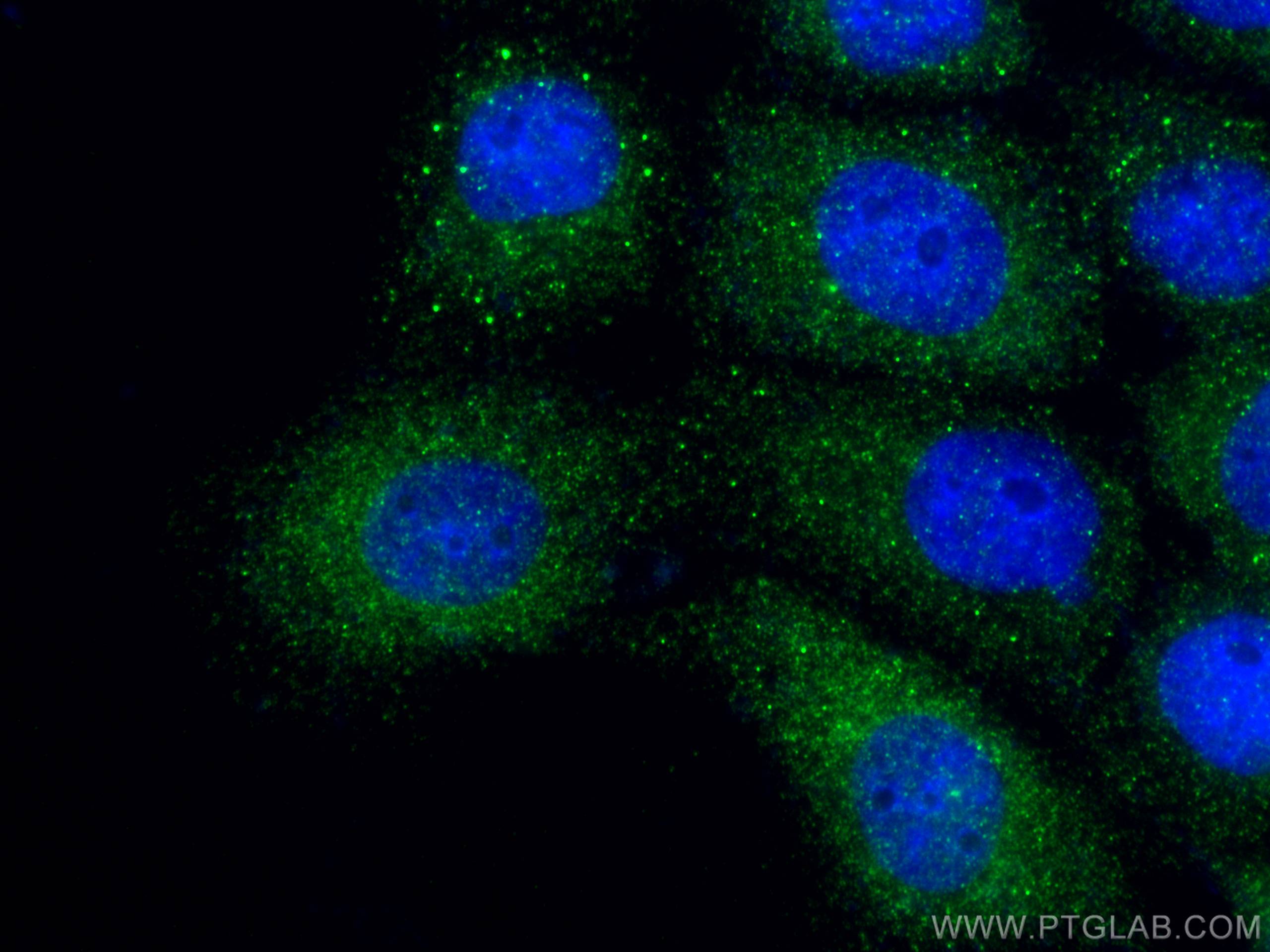 IF Staining of A431 using 28462-1-AP