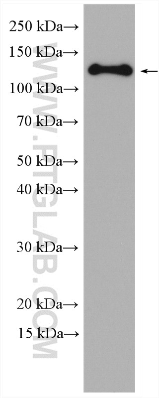 Western Blot (WB) analysis of A431 cells using Involucrin Polyclonal antibody (28462-1-AP)