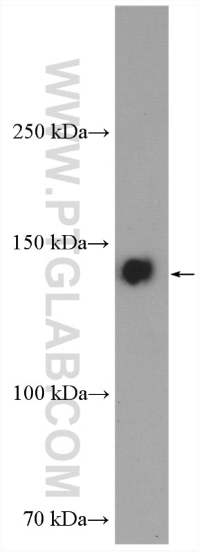Western Blot (WB) analysis of HT-1080 cells using Involucrin Polyclonal antibody (28462-1-AP)