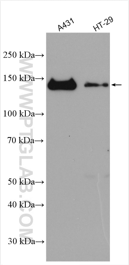 Western Blot (WB) analysis of various lysates using Involucrin Polyclonal antibody (28462-1-AP)