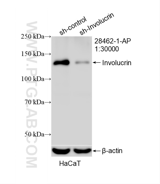 Western Blot (WB) analysis of HaCaT cells using Involucrin Polyclonal antibody (28462-1-AP)
