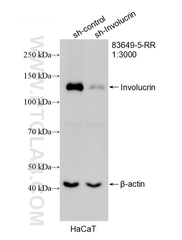 Western Blot (WB) analysis of HaCaT cells using Involucrin Recombinant monoclonal antibody (83649-5-RR)
