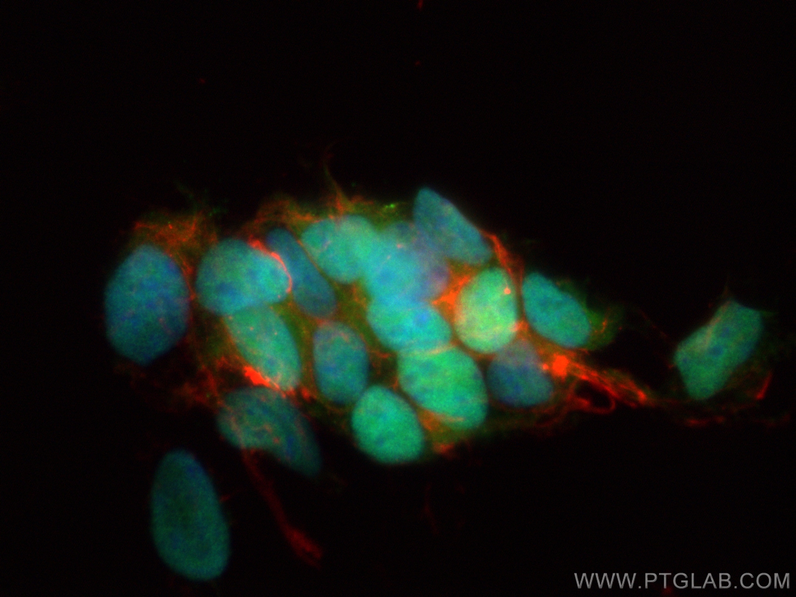 IF Staining of SH-SY5Y using CL488-15661