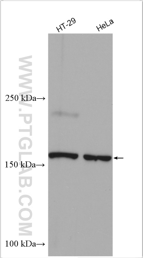 Western Blot (WB) analysis of various lysates using Jagged 2 Polyclonal antibody (19696-1-AP)