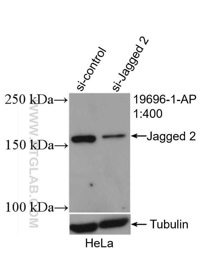 Western Blot (WB) analysis of HeLa cells using Jagged 2 Polyclonal antibody (19696-1-AP)