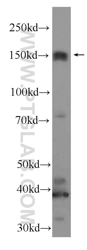 Jagged 2 Polyclonal antibody