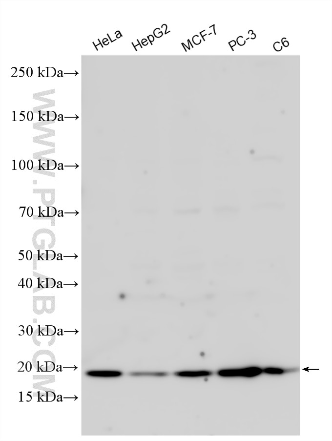 Western Blot (WB) analysis of various lysates using JAGN1 Polyclonal antibody (34193-1-AP)