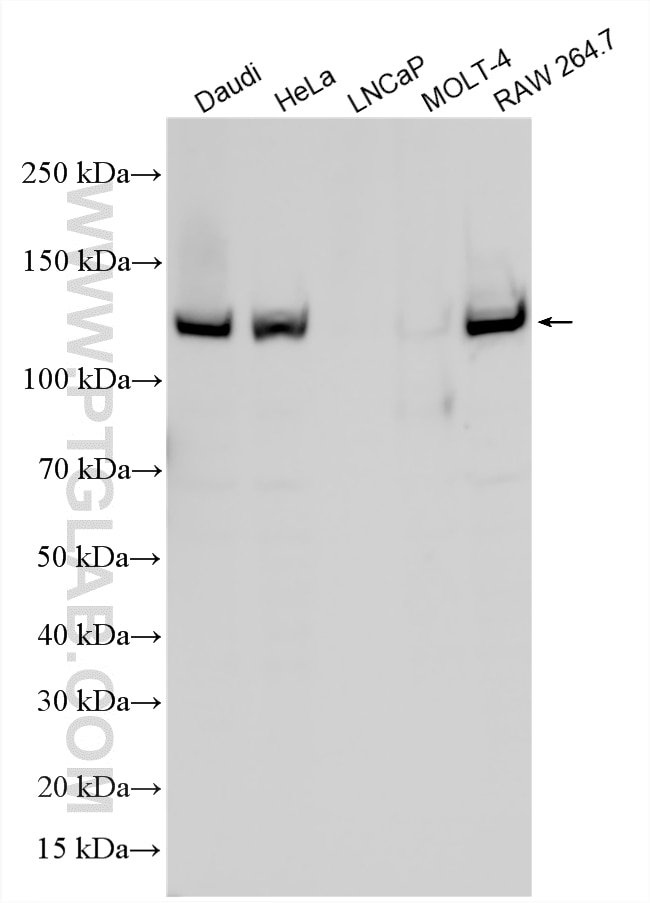 WB analysis using 27284-1-AP Western Blot (WB) analysis of various lysates using JAK1 Polyclonal antibody (27284-1-AP)