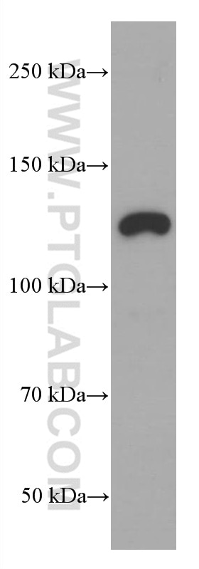 Western Blot (WB) analysis of rat spleen tissue using JAK1 Monoclonal antibody (66466-1-Ig)