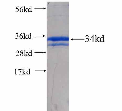 JAK1 fusion protein Ag25579 SDS-PAGE