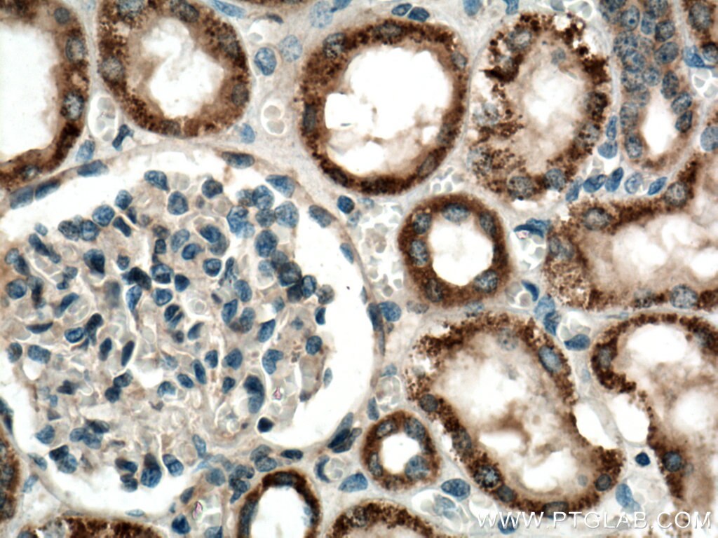 Immunohistochemistry (IHC) staining of human kidney tissue using JAK2 Polyclonal antibody (17670-1-AP)