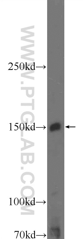 JAK2 Polyclonal antibody