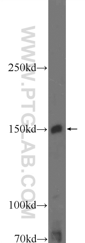 Western Blot (WB) analysis of Jurkat cells using JAK2 Polyclonal antibody (17670-1-AP)