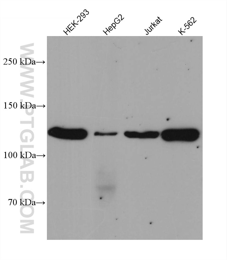 Western Blot (WB) analysis of various lysates using JAK3 Recombinant antibody (80331-1-RR)