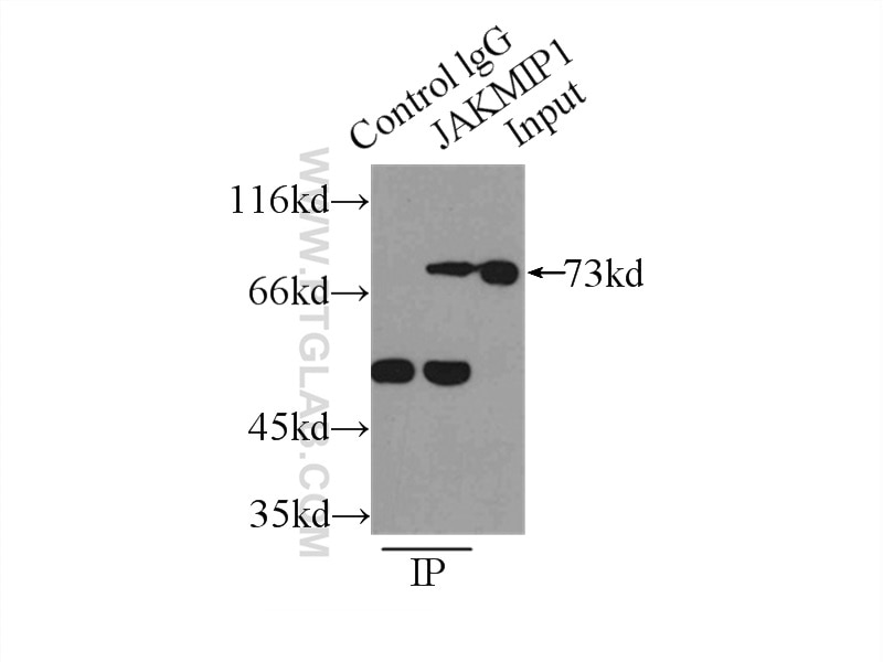 Immunoprecipitation (IP) experiment of Jurkat cells using JAKMIP1 Polyclonal antibody (13846-1-AP)