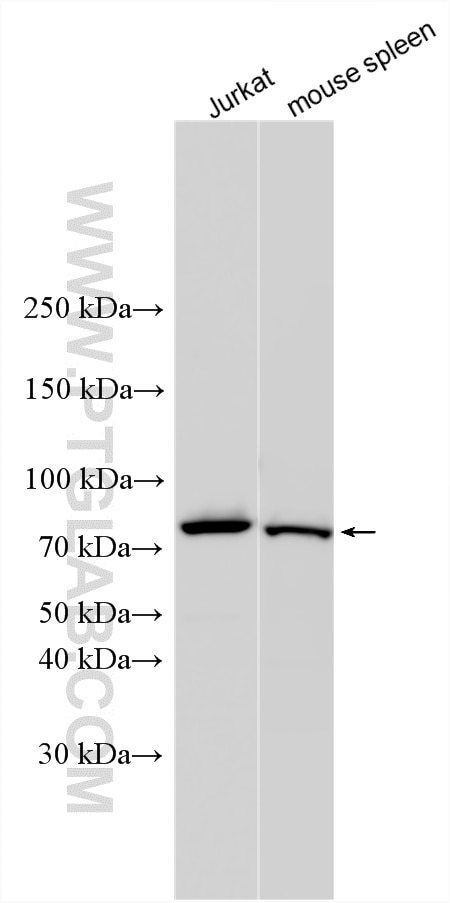 Western Blot (WB) analysis of various lysates using JAKMIP1 Polyclonal antibody (13846-1-AP)