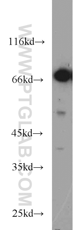 Western Blot (WB) analysis of Y79 cells using JAKMIP1 Polyclonal antibody (13846-1-AP)