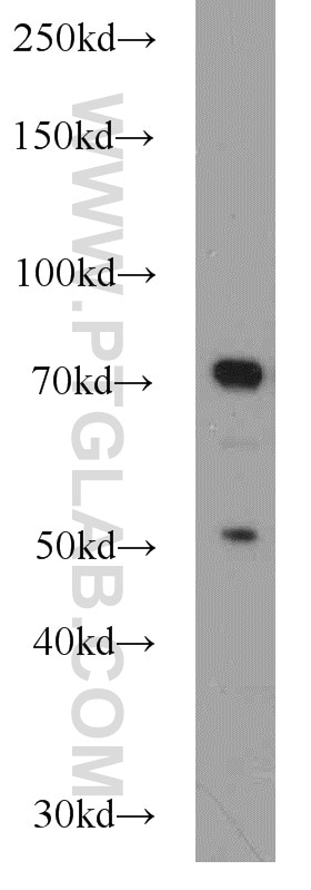 Western Blot (WB) analysis of HEK-293 cells using JAKMIP1 Polyclonal antibody (13846-1-AP)