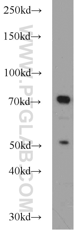 WB analysis of HEK-293 using 13846-1-AP