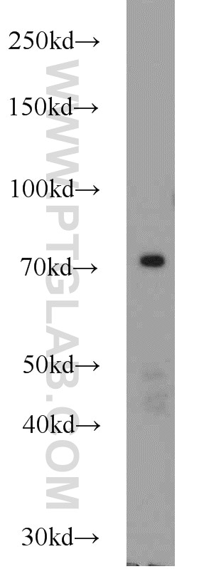 Western Blot (WB) analysis of mouse liver tissue using JAKMIP1 Polyclonal antibody (13846-1-AP)