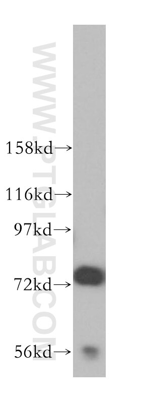 Western Blot (WB) analysis of mouse testis tissue using JAKMIP1 Polyclonal antibody (13846-1-AP)