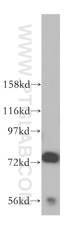 WB analysis of mouse testis using 13846-1-AP