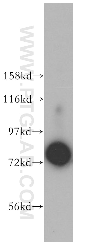 Western Blot (WB) analysis of Jurkat cells using JAKMIP1 Polyclonal antibody (13846-1-AP)
