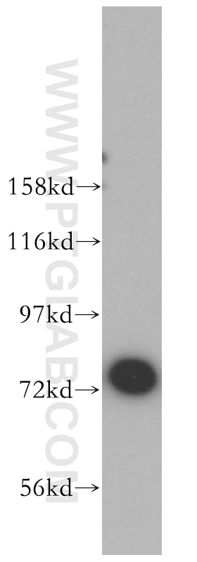 Western Blot (WB) analysis of mouse spleen tissue using JAKMIP1 Polyclonal antibody (13846-1-AP)