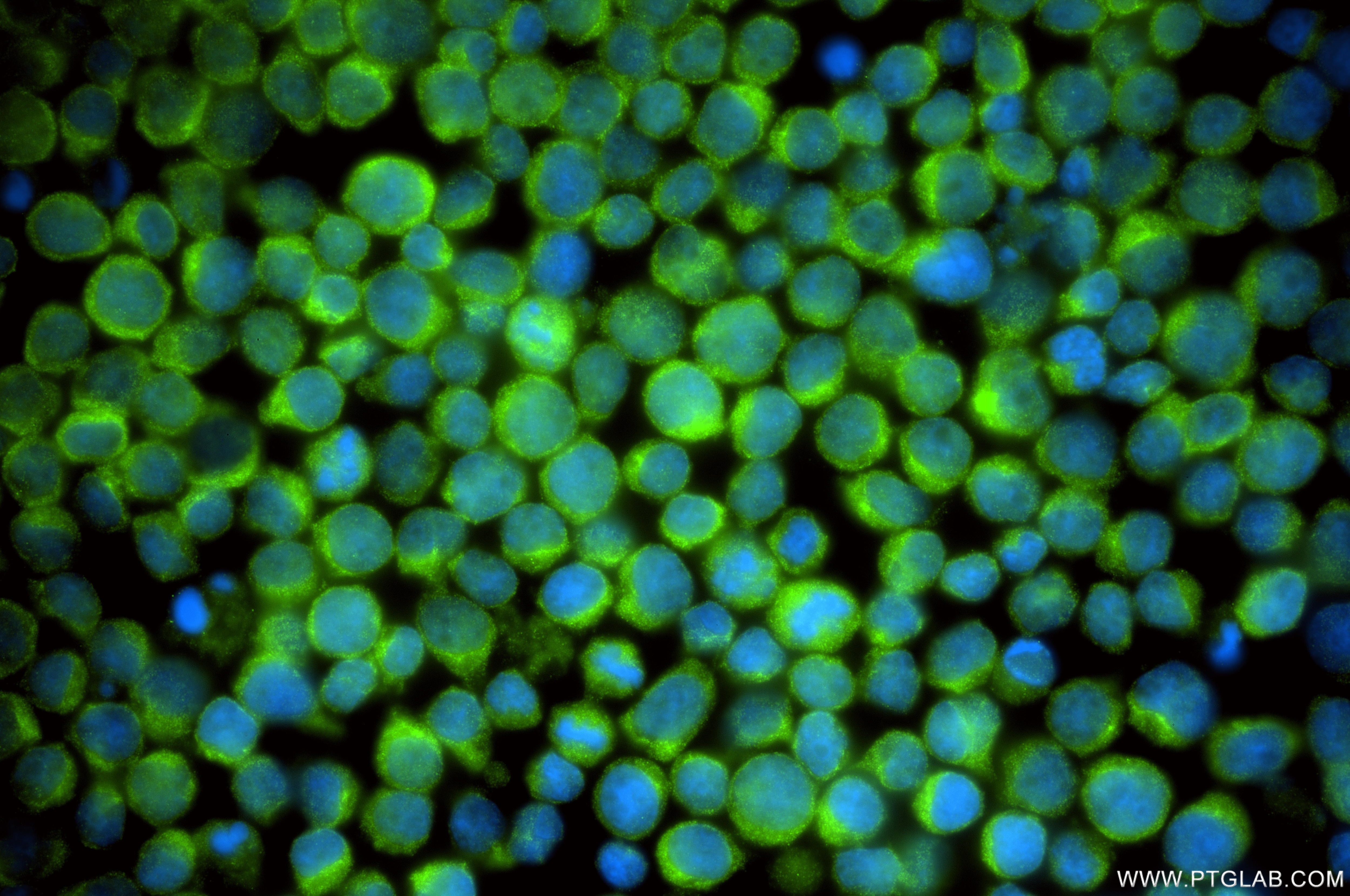Immunofluorescence (IF) / fluorescent staining of Jurkat cells using JAKMIP1 Recombinant monoclonal antibody (86257-3-RR)