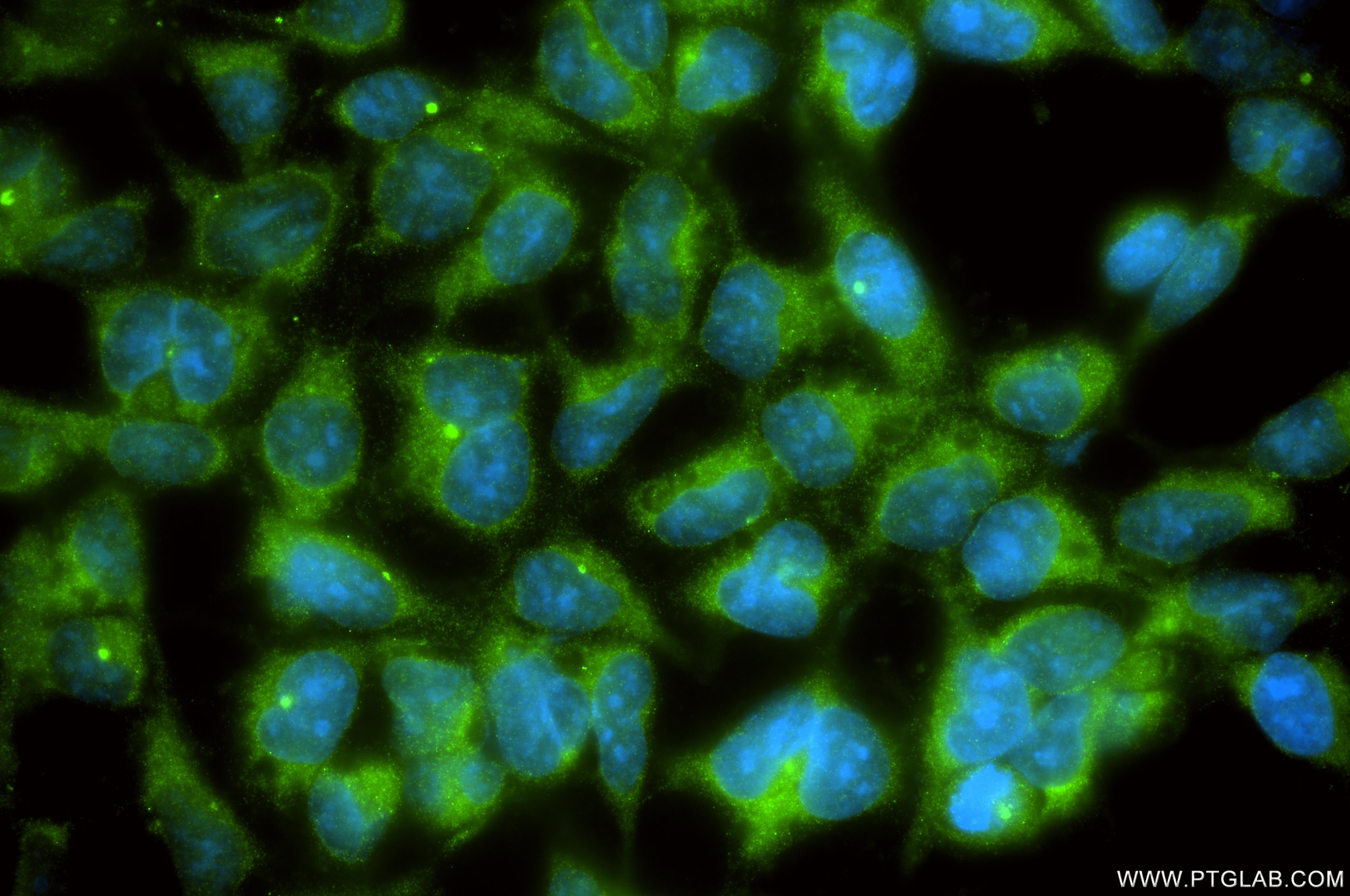 Immunofluorescence (IF) / fluorescent staining of HEK-293 cells using JAKMIP1 Recombinant monoclonal antibody (86257-3-RR)