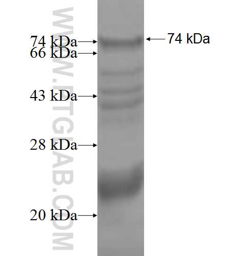 JAKMIP1 fusion protein Ag4816 SDS-PAGE