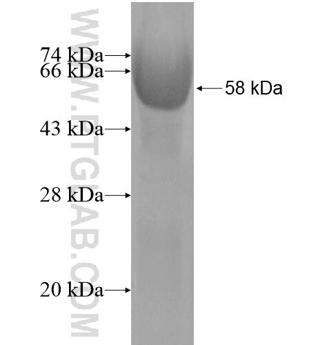 JAKMIP2 fusion protein Ag10551 SDS-PAGE