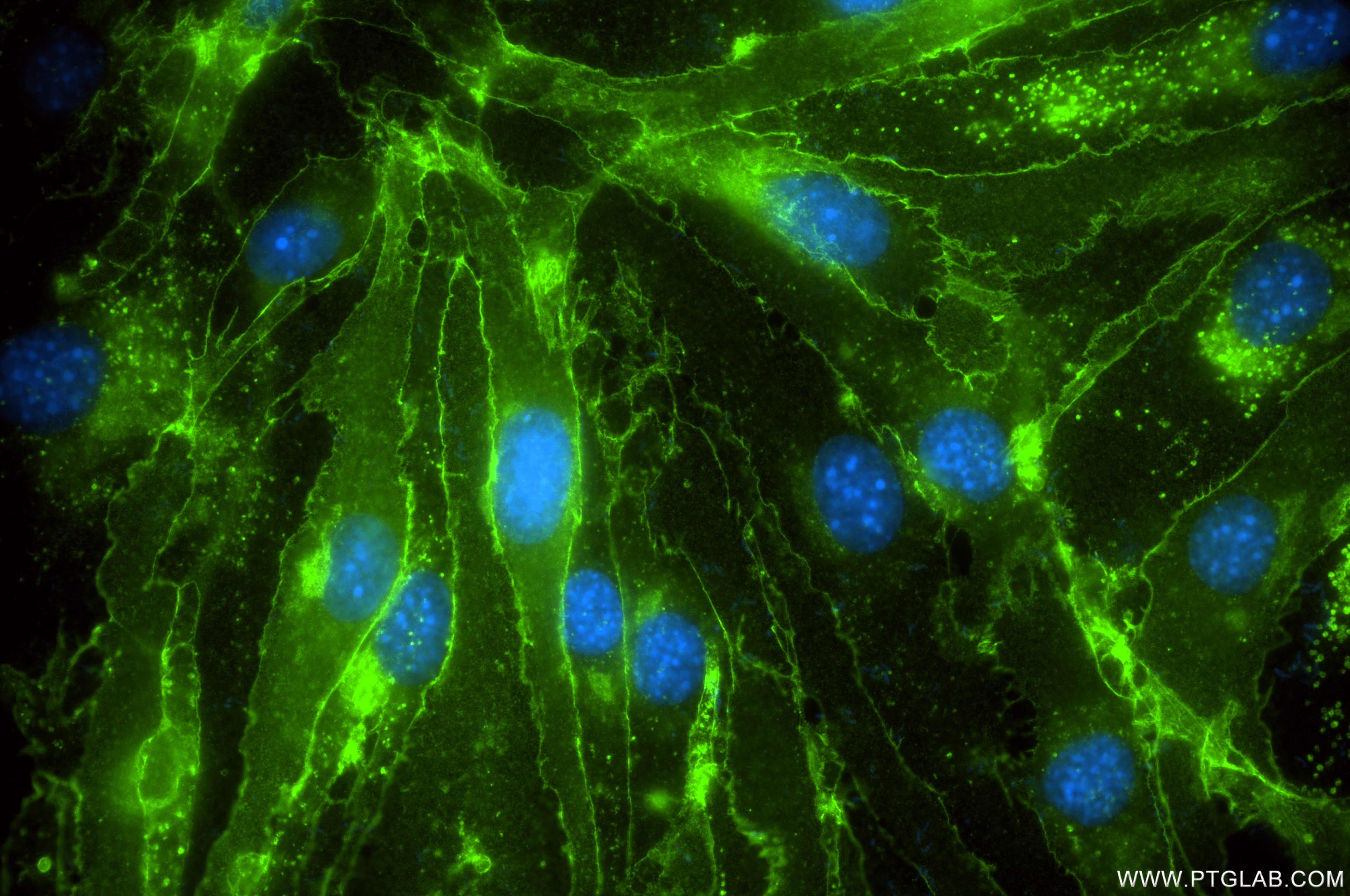 Immunofluorescent analysis of (4% PFA) fixed bEnd.3 cells using JAM-A/CD321 antibody (86229-1-RR, Clone: 250060H5 ) at dilution of 1:800 and CoraLite®488-Conjugated Goat Anti-Rabbit IgG(H+L) (SA00013-2). Immunofluorescence (IF) / fluorescent staining of bEnd.3 cells using JAM-A/CD321 Recombinant antibody (86229-1-RR)
