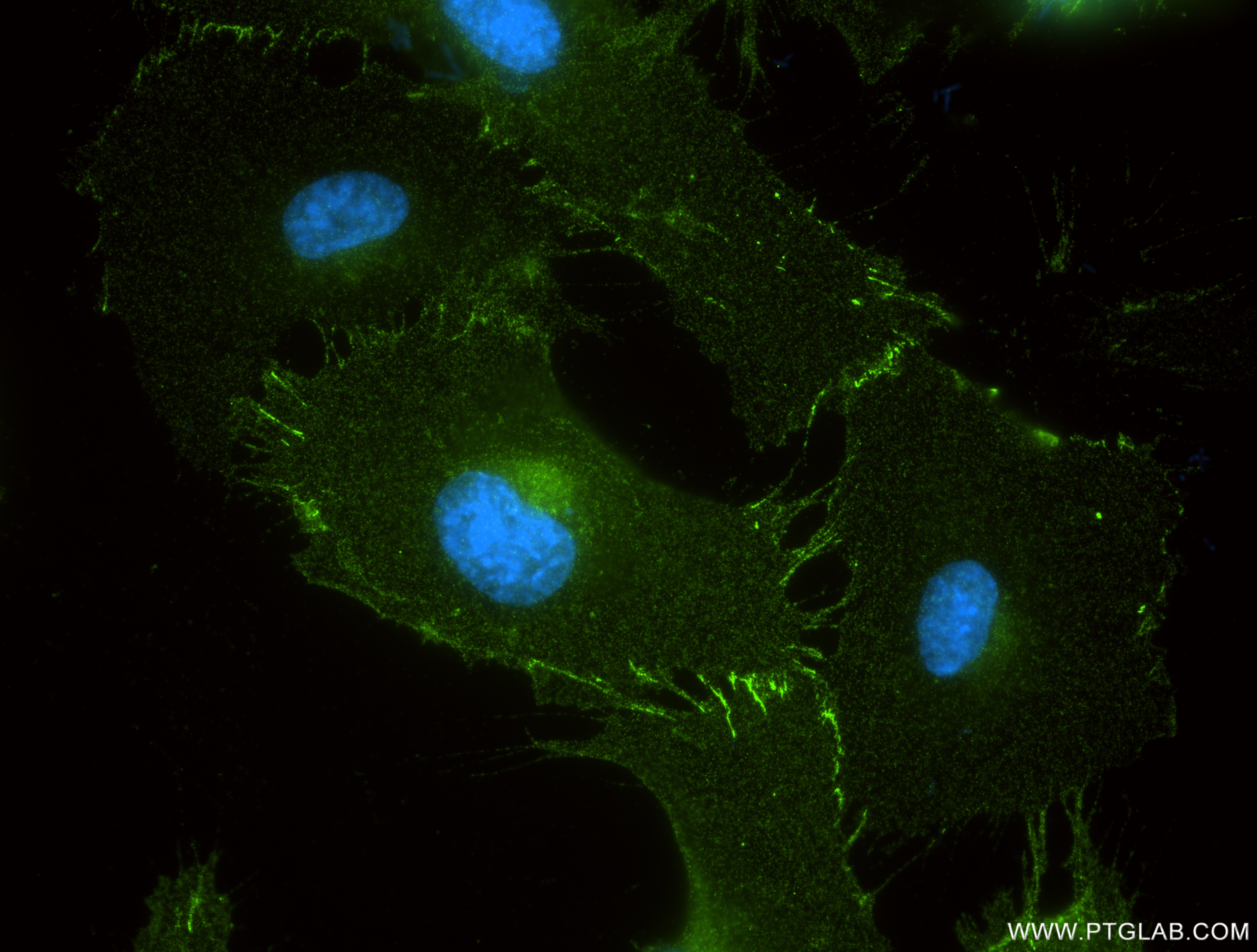IF Staining of HUVEC using 84720-2-RR Immunofluorescence (IF) / fluorescent staining of HUVEC cells using JAM-A/CD321 Recombinant monoclonal antibody (84720-2-RR)