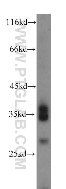 Western Blot (WB) analysis of human heart tissue using JAM2 Polyclonal antibody (12972-1-AP)