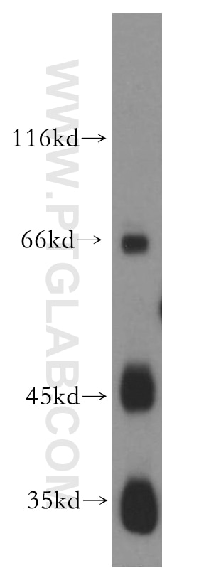 Western Blot (WB) analysis of human placenta tissue using JAM2 Polyclonal antibody (12972-1-AP)