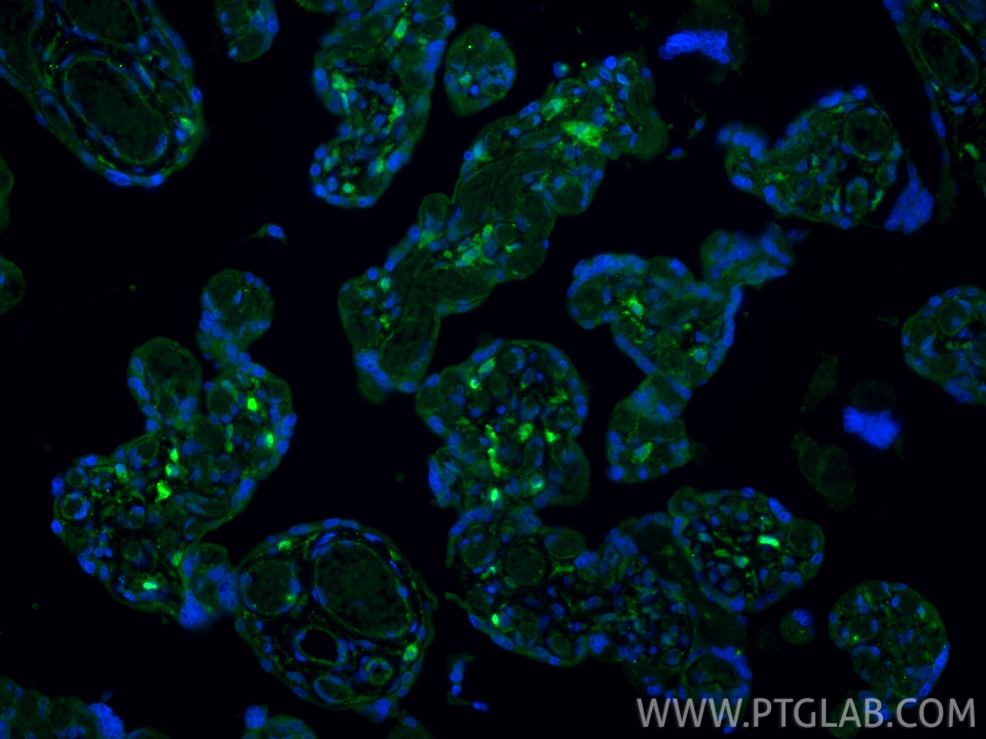IF Staining of human placenta using 34226-1-AP Immunofluorescence (IF) / fluorescent staining of human placenta tissue using JAM2 Polyclonal antibody (34226-1-AP)