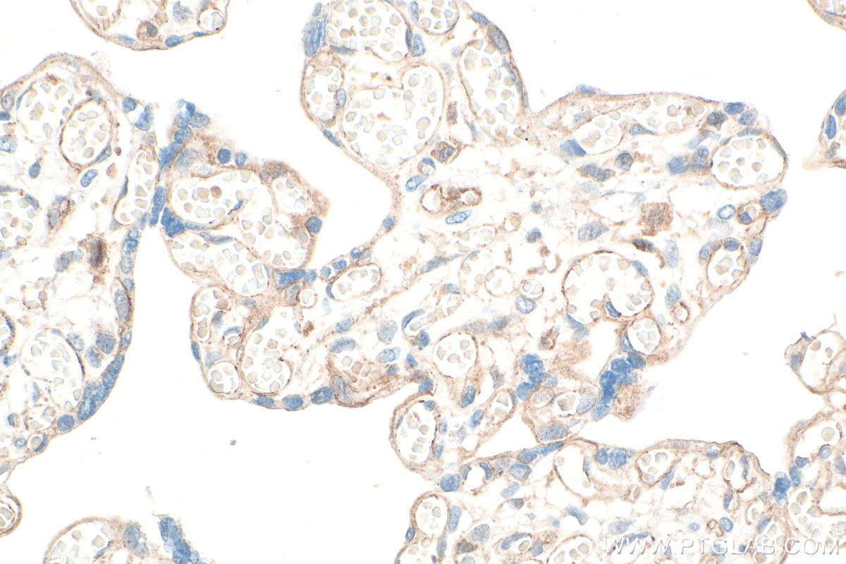 IHC staining of human placenta using 34226-1-AP Immunohistochemistry (IHC) staining of human placenta tissue using JAM2 Polyclonal antibody (34226-1-AP)
