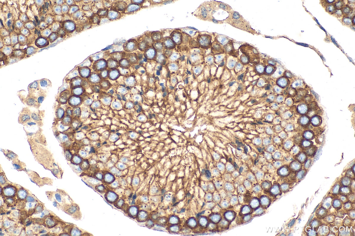 Immunohistochemistry (IHC) staining of mouse testis tissue using JAM3 Polyclonal antibody (32424-1-AP)